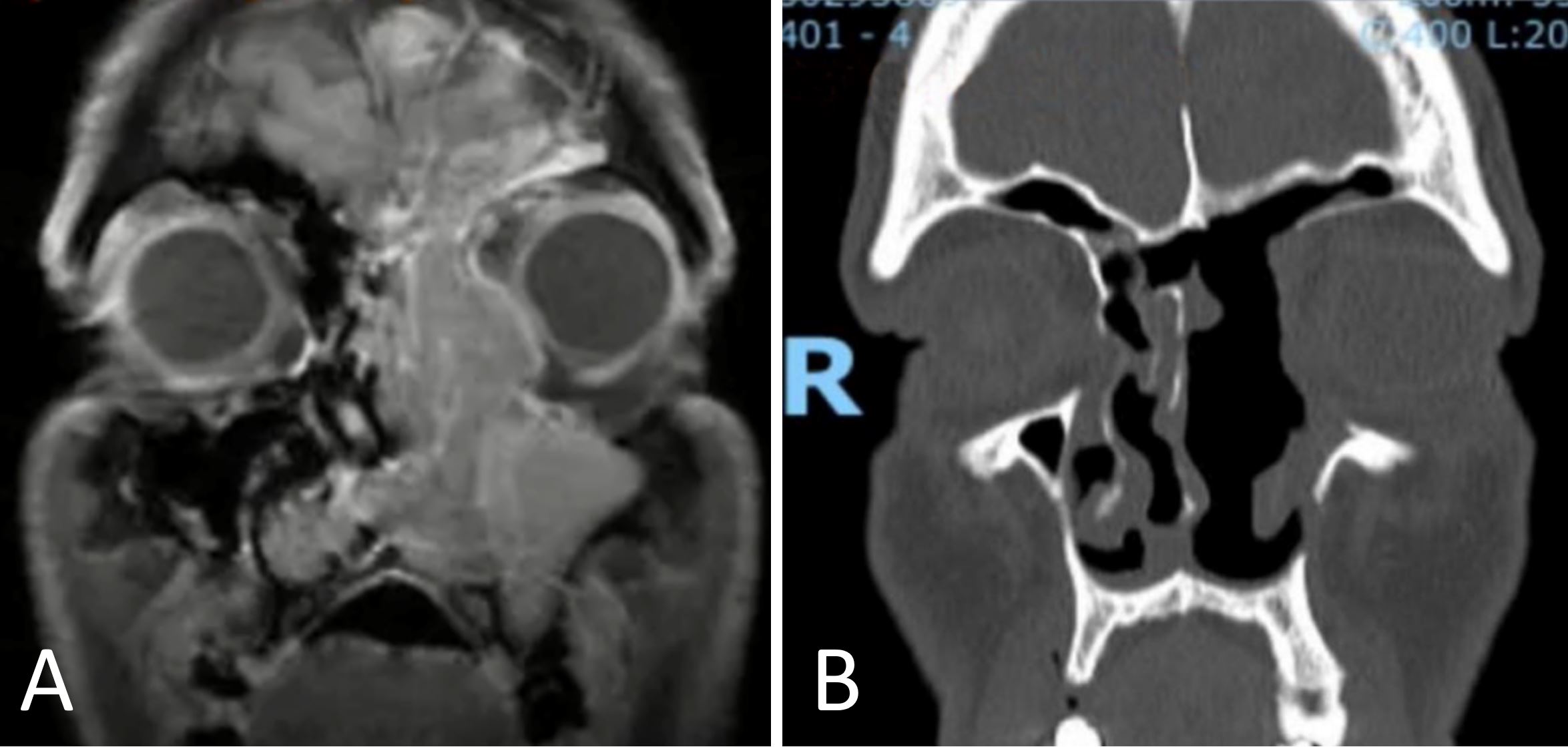 Figure 1.JPG